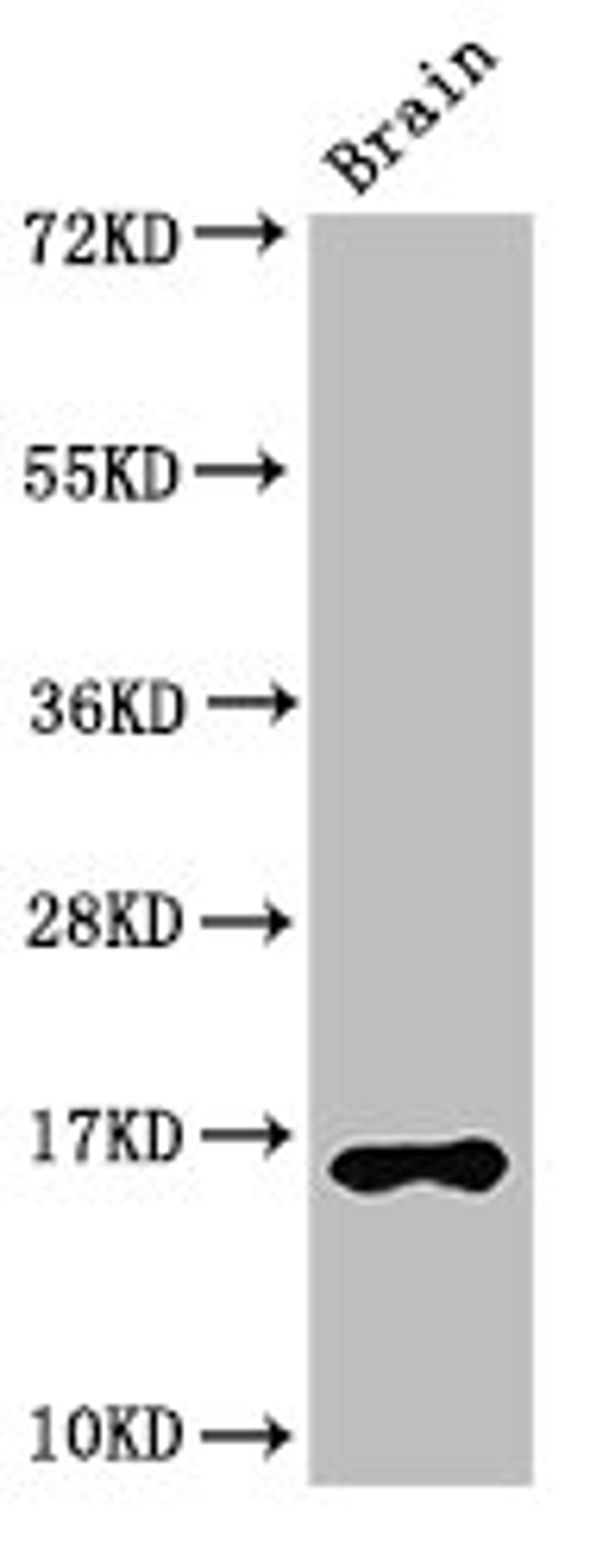 Western Blot. Positive WB detected in: Mouse brain tissue. All lanes: HIST1H3A antibody at 2.5µg/ml. Secondary. Goat polyclonal to rabbit IgG at 1/50000 dilution. Predicted band size: 16 kDa. Observed band size: 16 kDa