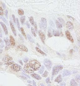 Detection of human REA by immunohistochemistry.