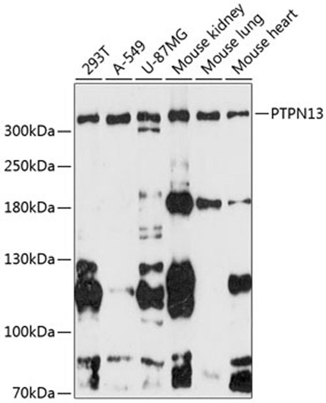 Western blot - PTPN13 antibody (A13005)