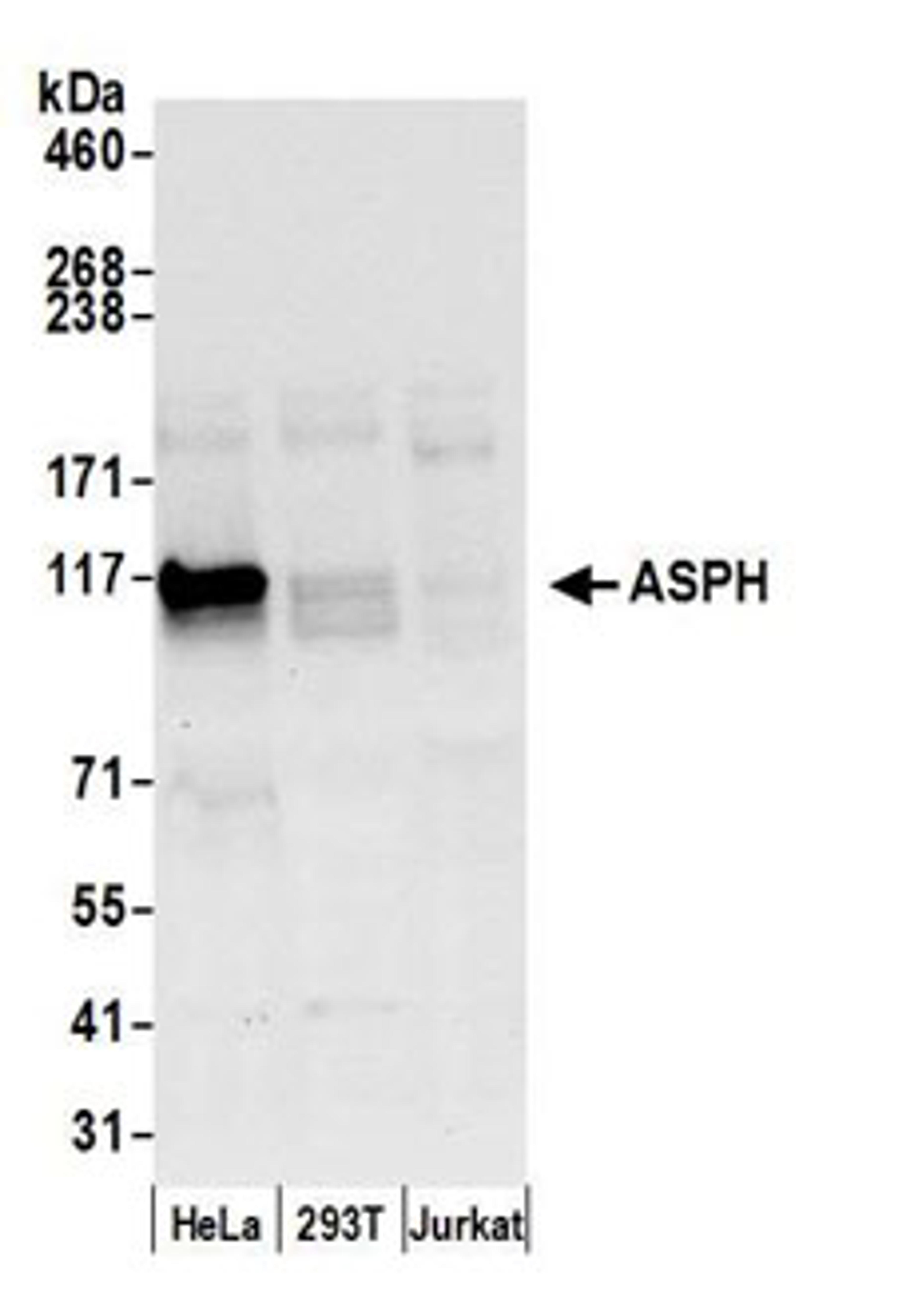 Detection of human ASPH by western blot.