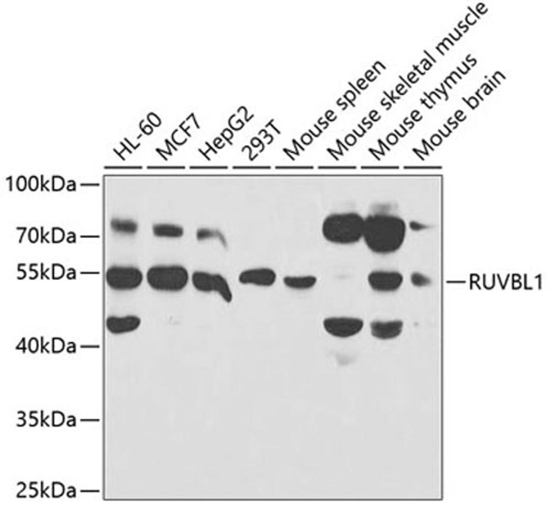 Western blot - RUVBL1 antibody (A5723)