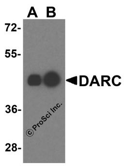 Western blot analysis of DARC in human liver tissue lysate with DARC antibody at (A) 0.25 and (B) 0.5 μg/mL.