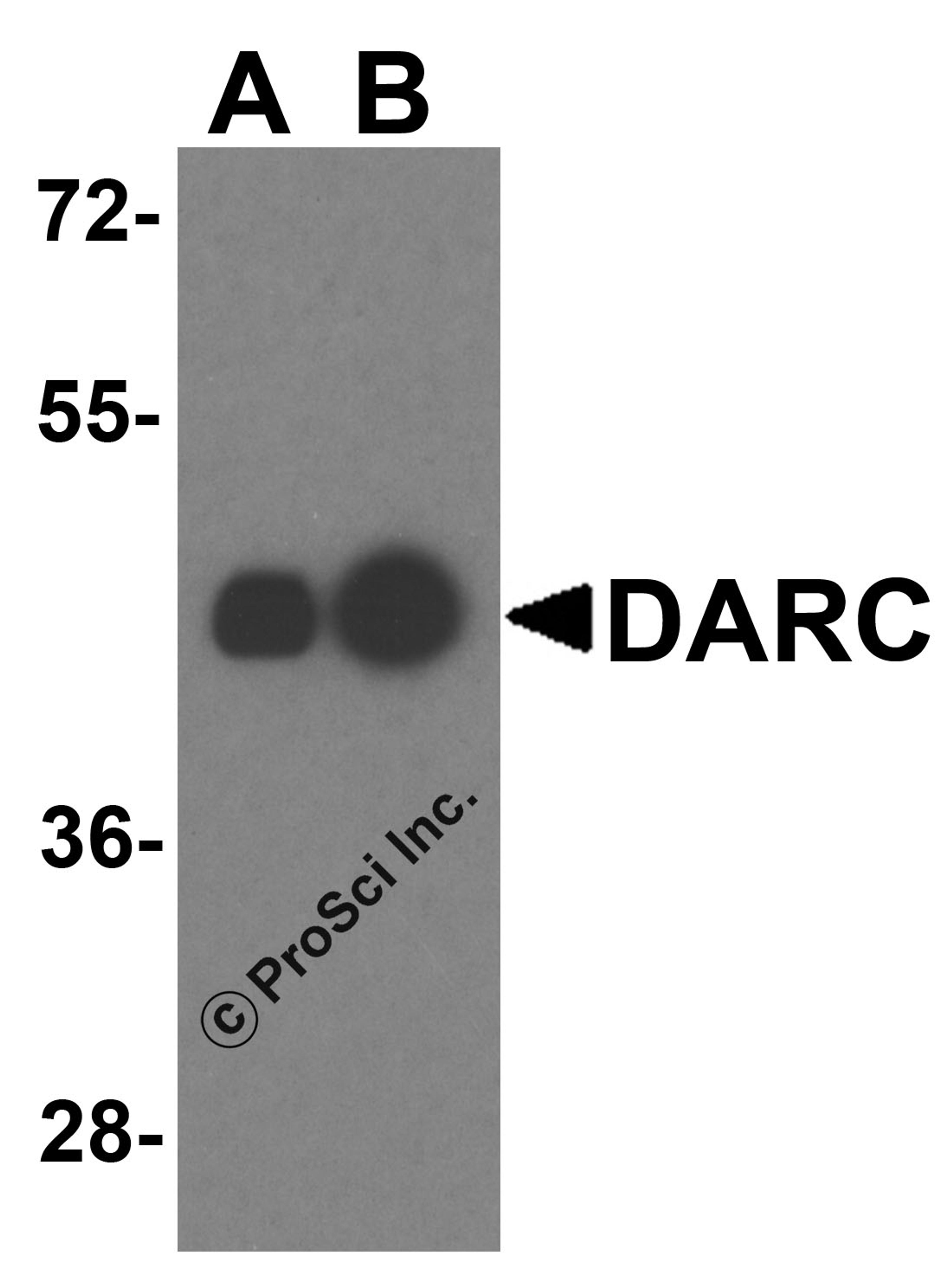 Western blot analysis of DARC in human liver tissue lysate with DARC antibody at (A) 0.25 and (B) 0.5 μg/mL.