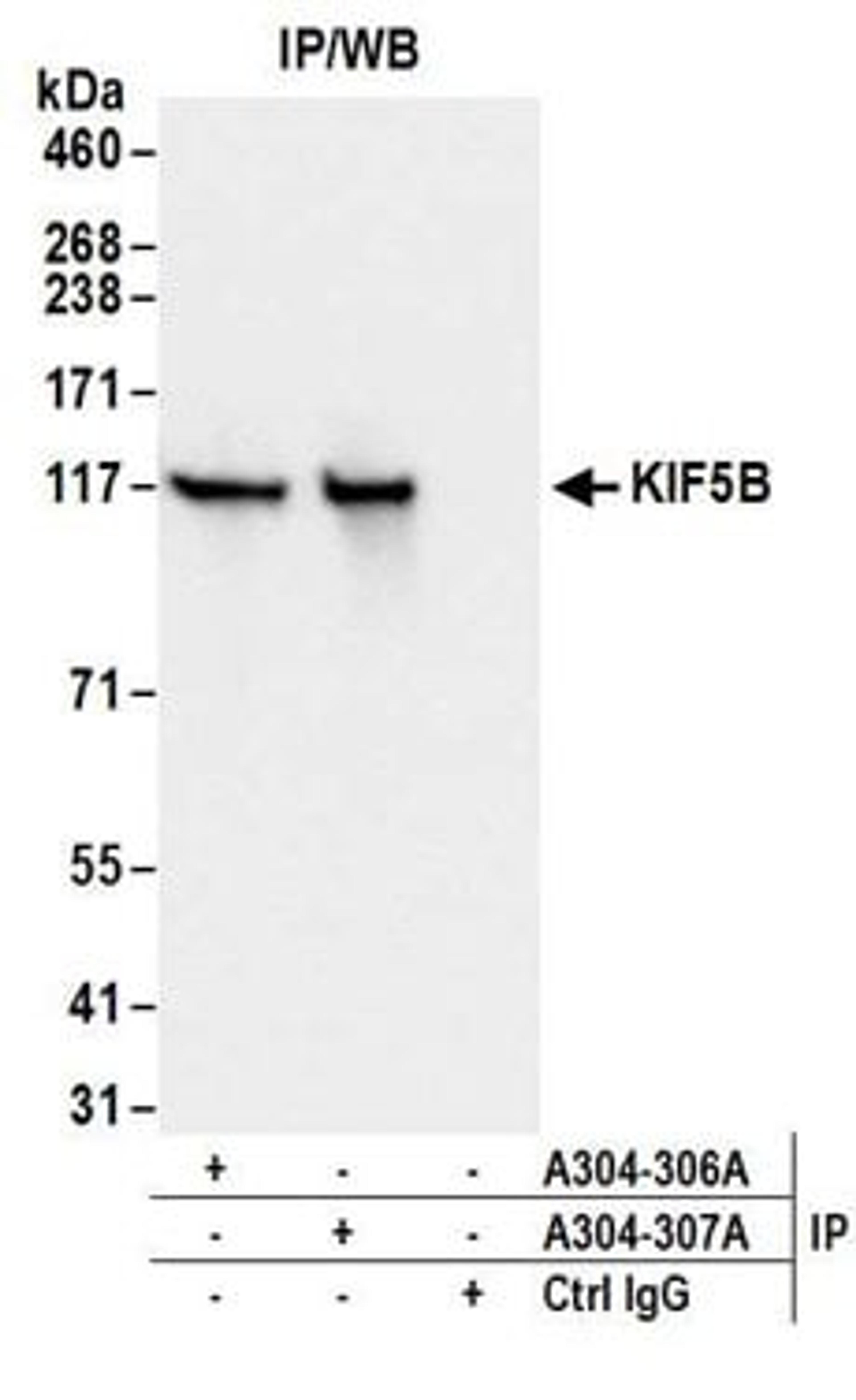 Detection of human KIF5B by western blot of immunoprecipitates.