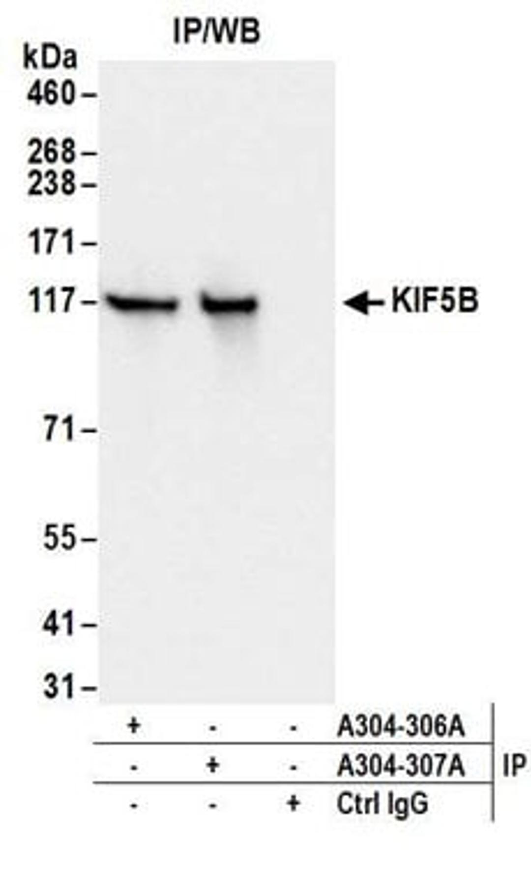 Detection of human KIF5B by western blot of immunoprecipitates.