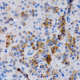 Immunohistochemistry - CYP24A1 antibody (A1805)
