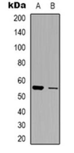 Western blot analysis of ZNT1 expression in HepG2 (Lane 1), U251 (Lane 2) whole cell lysates using SLC30A1 antibody