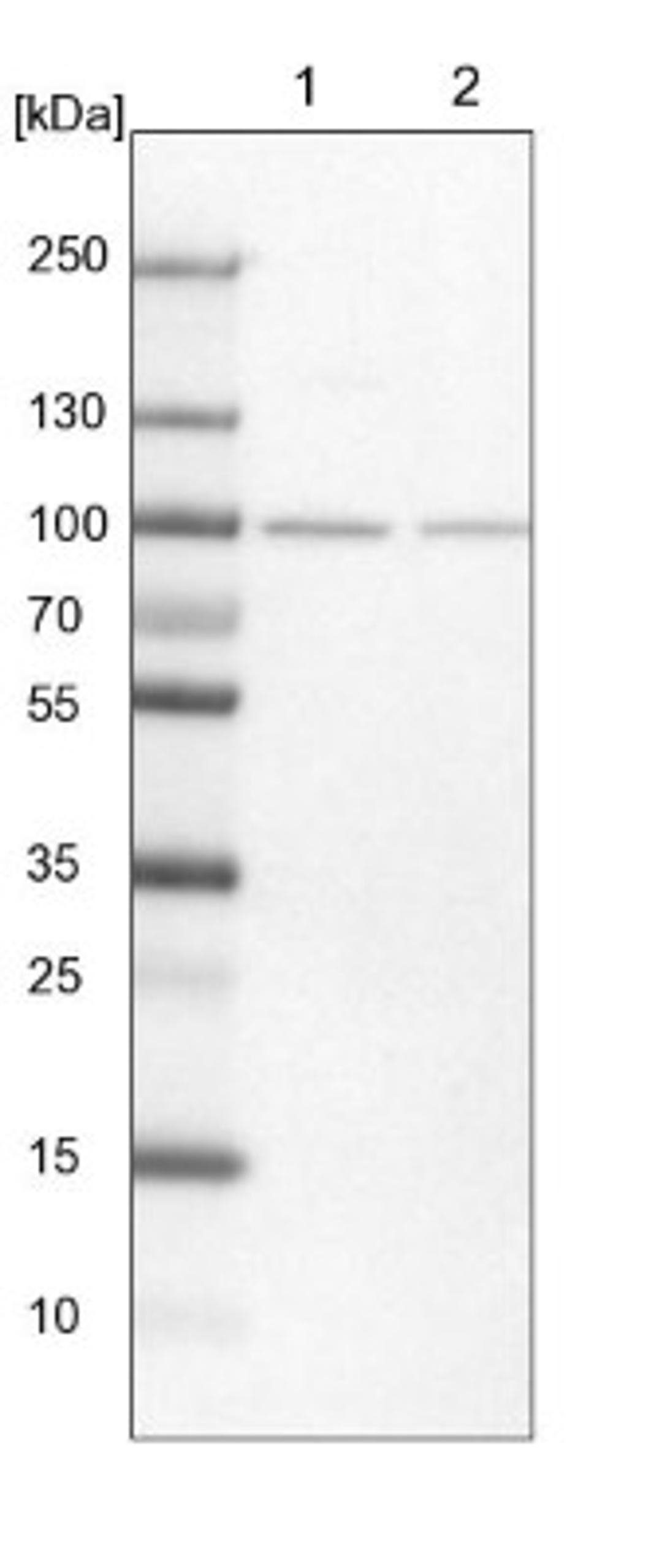 Western Blot: SLITRK5 Antibody [NBP1-90798] - Lane 1: NIH-3T3 cell lysate (Mouse embryonic fibroblast cells)<br/>Lane 2: NBT-II cell lysate (Rat Wistar bladder tumour cells)