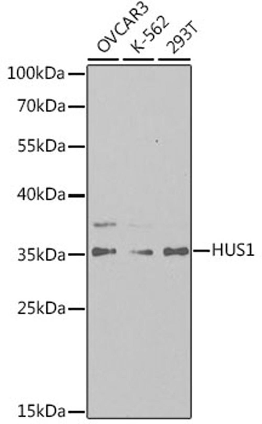 Western blot - HUS1 antibody (A5407)