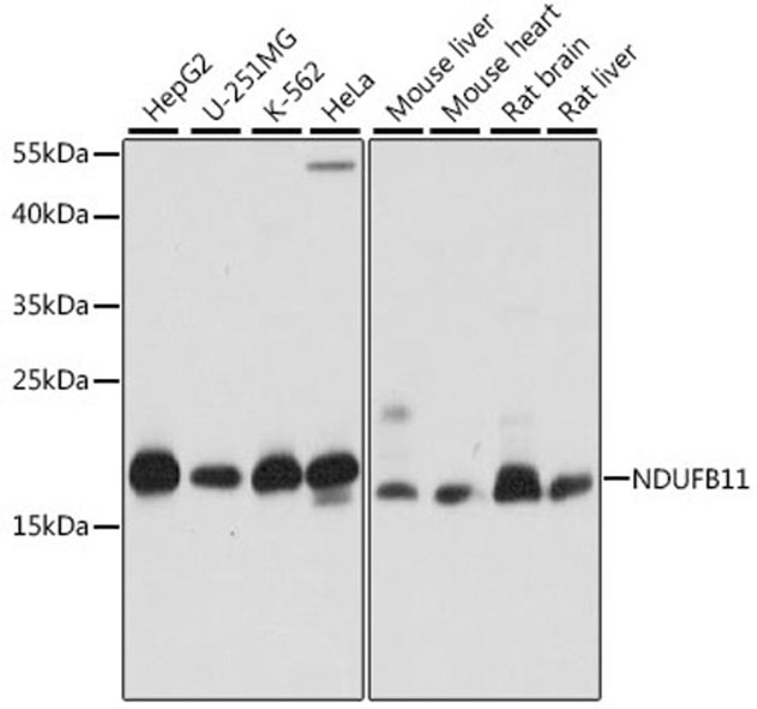 Western blot - NDUFB11 antibody (A15617)