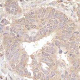 Detection of human eIF2A by immunohistochemistry.