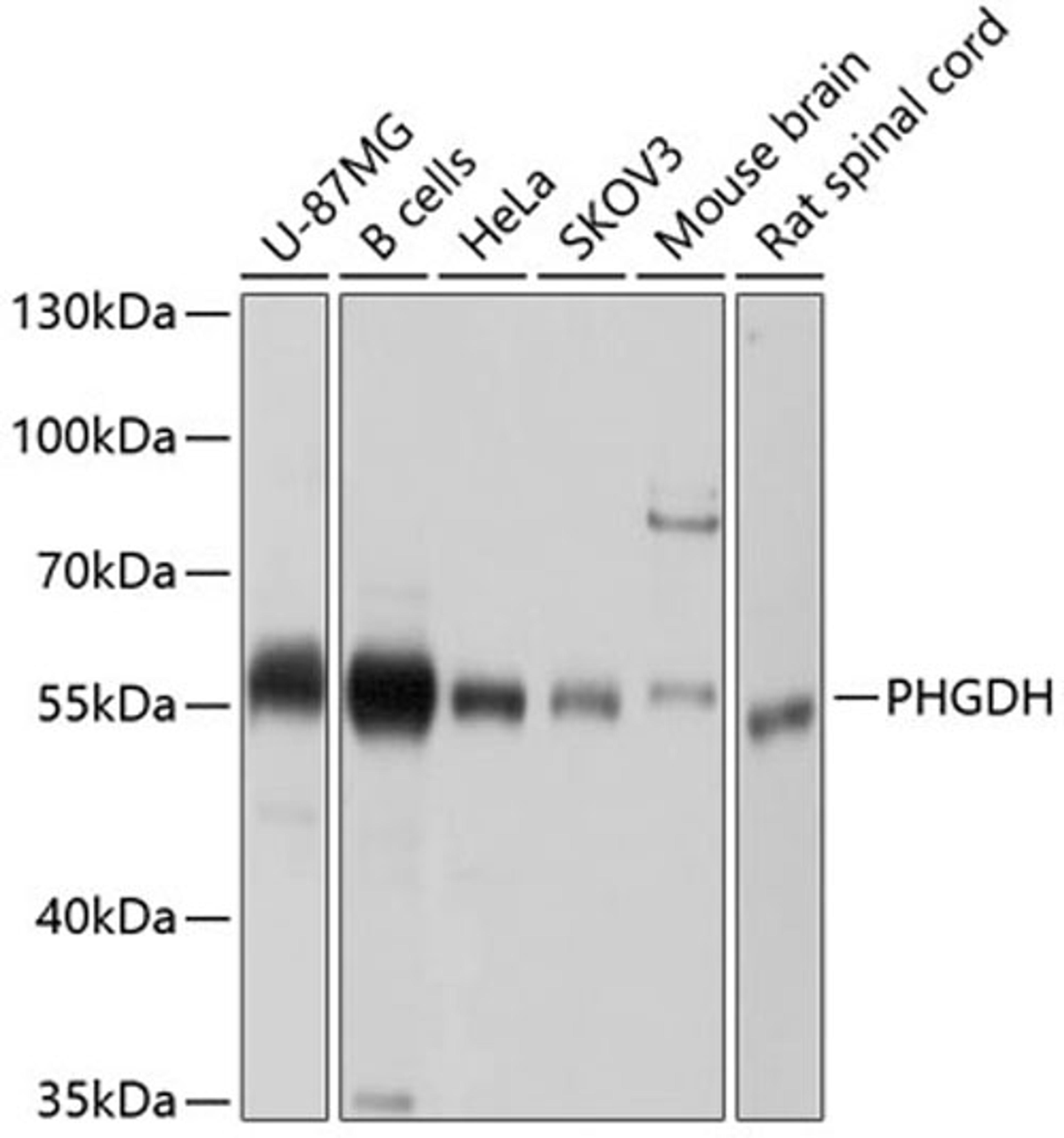 Western blot - PHGDH antibody (A10461)