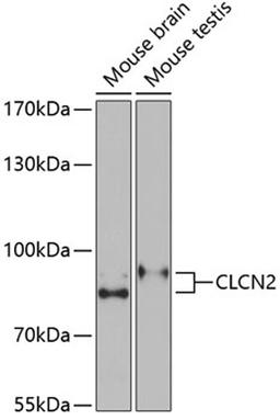 Western blot - CLCN2 Antibody (A6120)