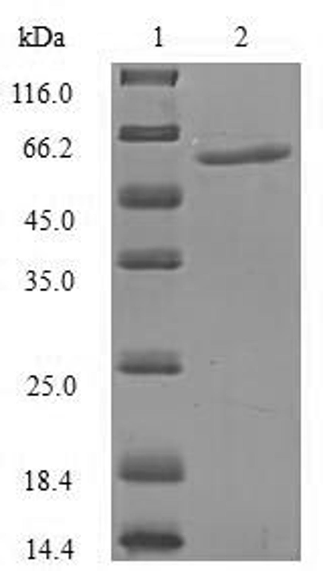 (Tris-Glycine gel) Discontinuous SDS-PAGE (reduced) with 5% enrichment gel and 15% separation gel.