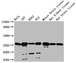 Western Blot. Positive WB detected in: Hela whole cell lysate, U87 whole cell lysate, K562 whole cell lysate, PC3 whole cell lysate, Mouse brain tissue, Rat kidney tissue, Rat brain tissue. All lanes: METRNL antibody at 1:2000. Secondary. Goat polyclonal to rabbit IgG at 1/50000 dilution. Predicted band size: 35, 26 KDa. Observed band size: 35 KDa. Exposure time：1min. 