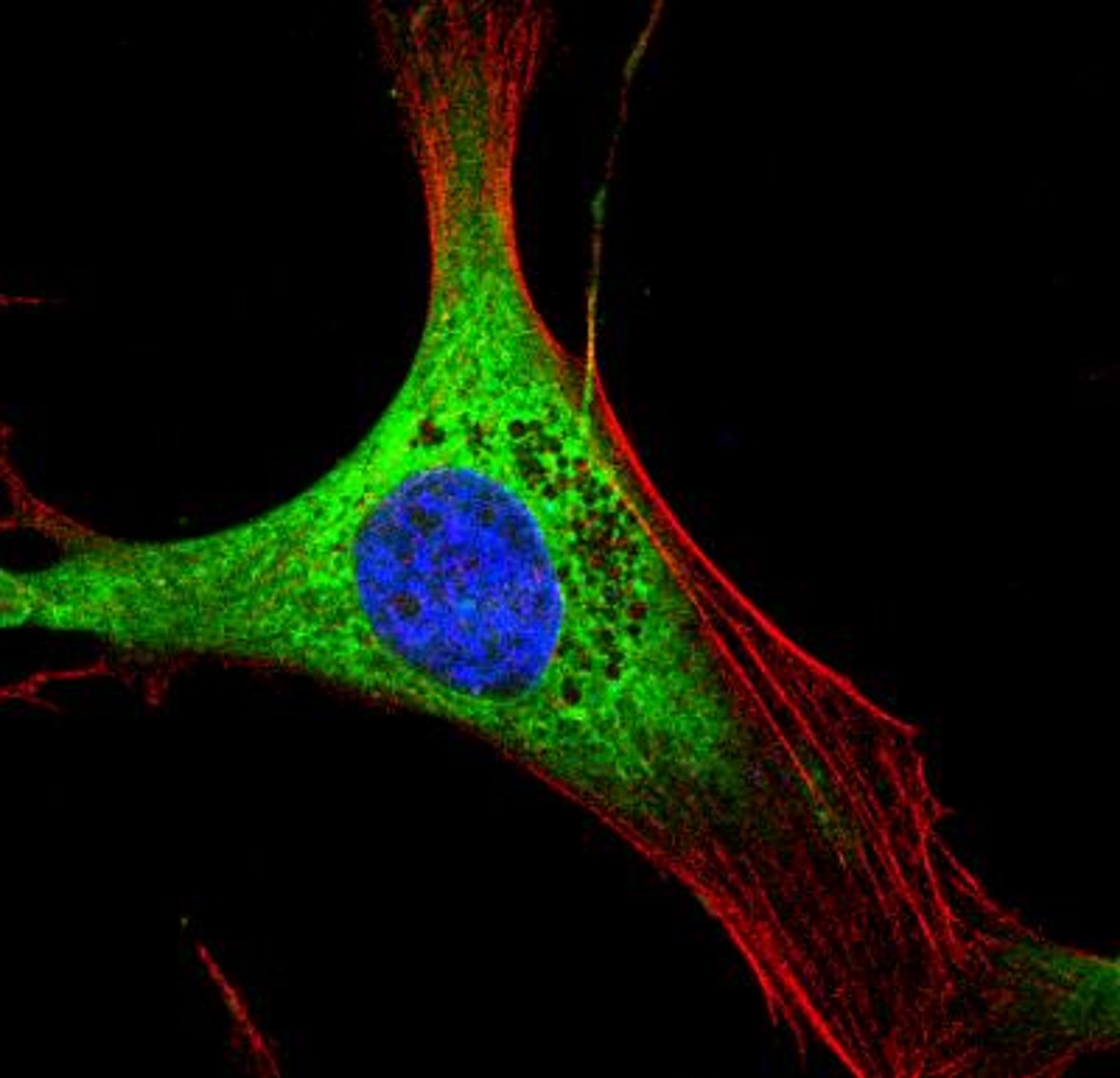 Immunocytochemistry/Immunofluorescence: Calreticulin Antibody [NB600-103] - IF Confocal analysis of 3T3 cells using Calreticulin antibody (NB600-103, 1:20). An Alexa Fluor 488-conjugated Goat to rabbit IgG was used as secondary antibody (green). Actin filaments were labeled with Alexa Fluor 568 phalloidin (red). DAPI was used to stain the cell nuclei (blue).