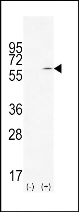 Western blot analysis of TIEG using rabbit polyclonal TIEG Antibody using 293 cell lysates (2 ug/lane) either nontransfected (Lane 1) or transiently transfected (Lane 2) with the TIEG gene.