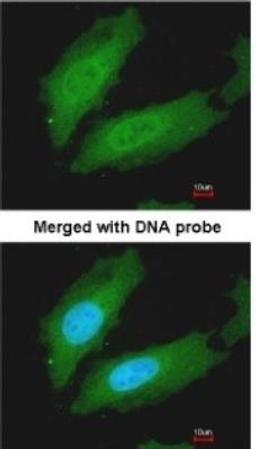 Immunocytochemistry/Immunofluorescence: MuRF1/TRIM63 Antibody [NBP1-31207] - Paraformaldehyde-fixed HeLa, using antibody at 1:200 dilution.