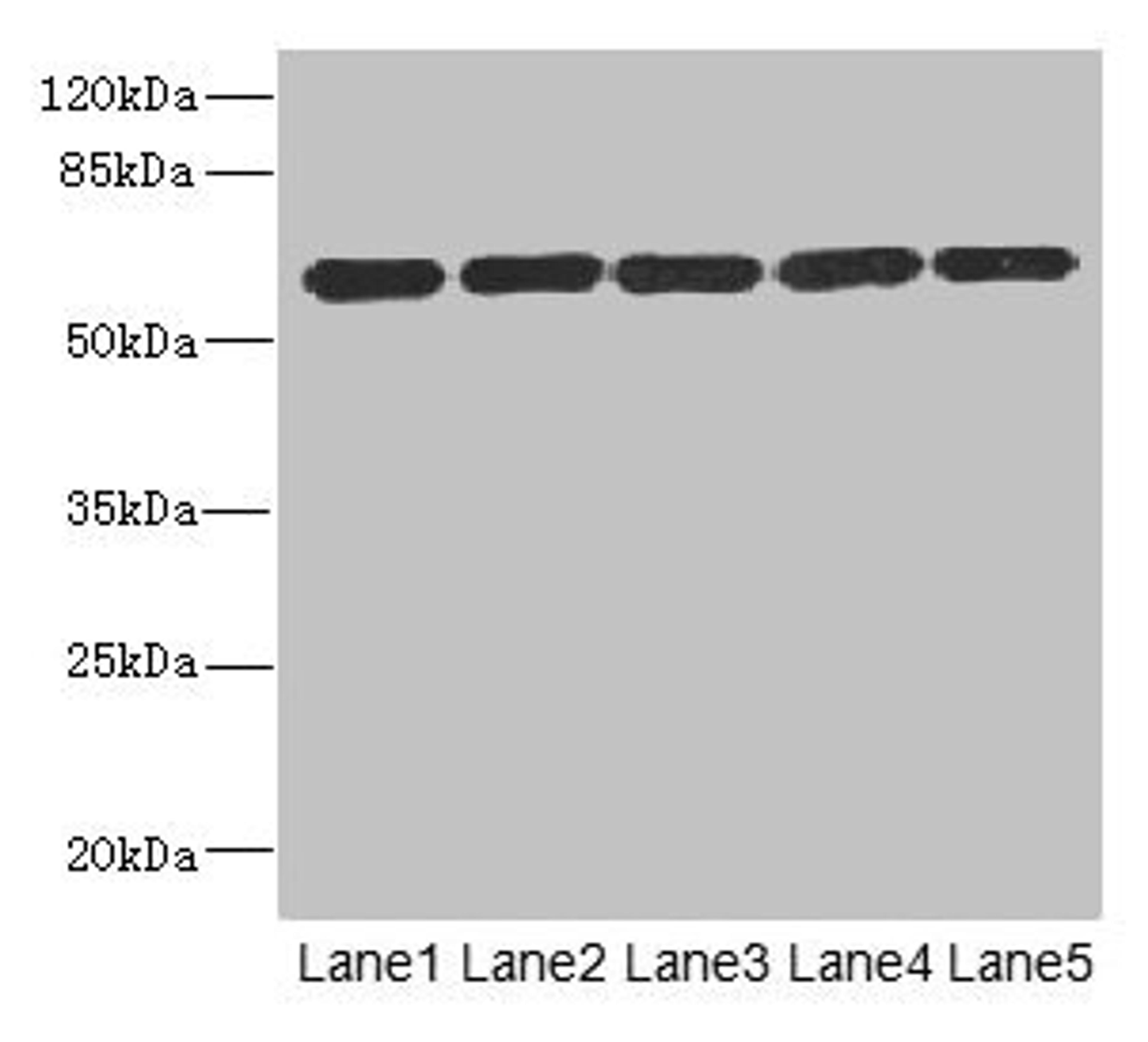 Western blot. All lanes: ARHGEF3 antibody at 2.21µg/ml. Lane 1: MCF-7 whole cell lysate. Lane 2: HepG2 whole cell lysate. Lane 3: Jurkat whole cell lysate. Lane 4: Hela whole cell lysate. Lane 5: 293T whole cell lysate. Secondary. Goat polyclonal to rabbit IgG at 1/10000 dilution. Predicted band size: 60, 64, 61, 37 kDa. Observed band size: 60 kDa