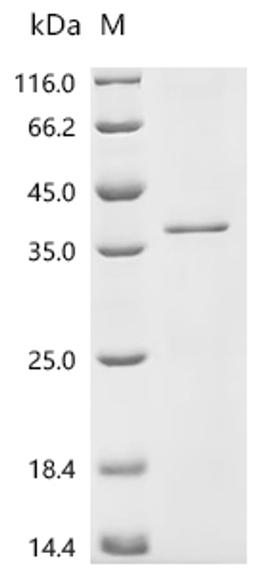 (Tris-Glycine gel) Discontinuous SDS-PAGE (reduced) with 5% enrichment gel and 15% separation gel.