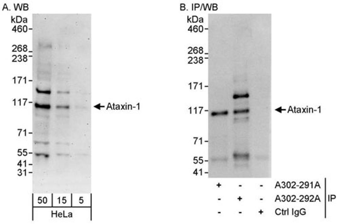 Detection of human Ataxin-1 by WB and IP.