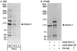 Detection of human Ataxin-1 by WB and IP.