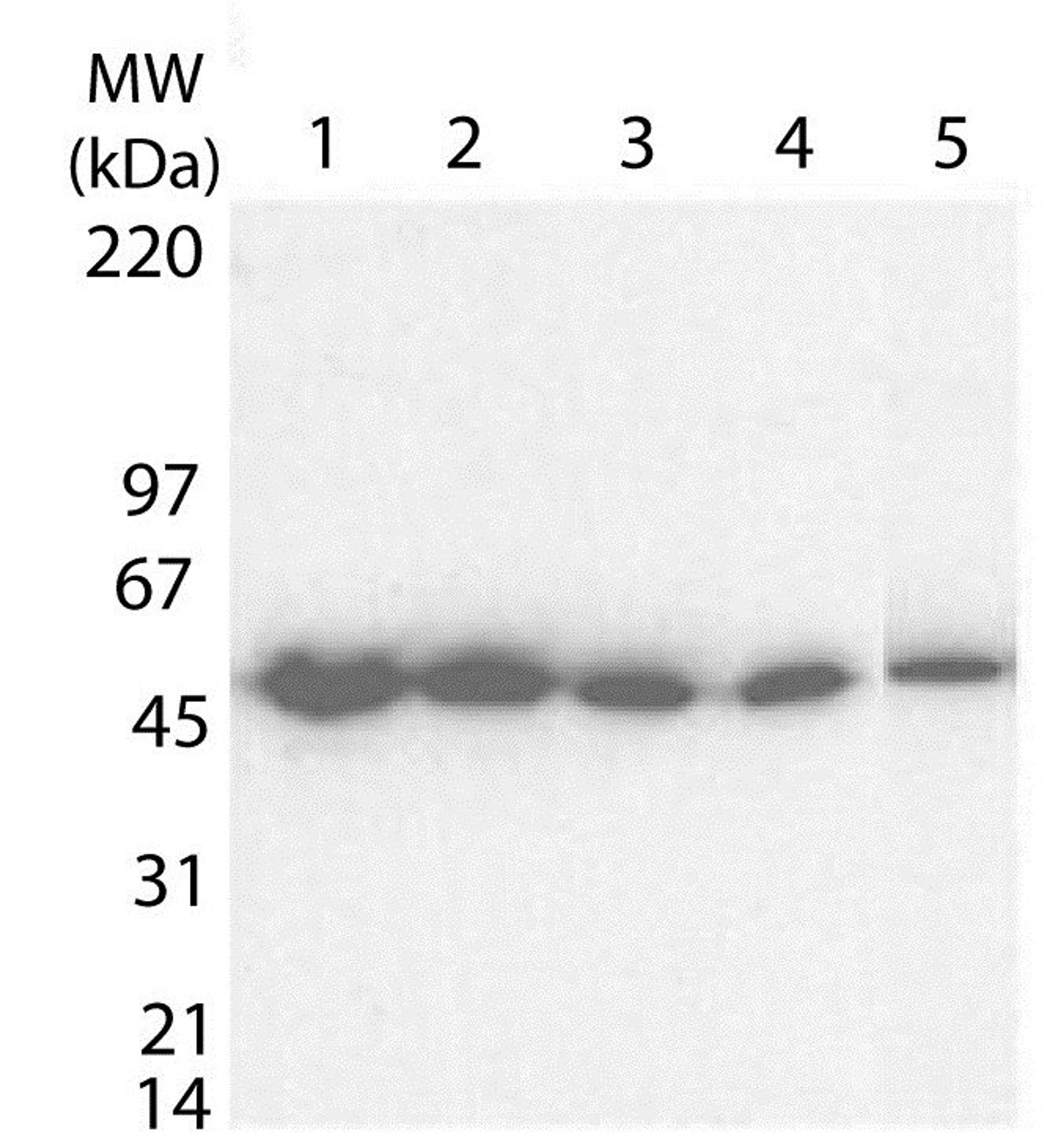 Western blot analysis of Lanes 1-5 contain 10 ng, 5 ng, 2.5 ng, 1.25 ng and 0.625 ng respectively using Tetanus Toxic Fragment C antibody