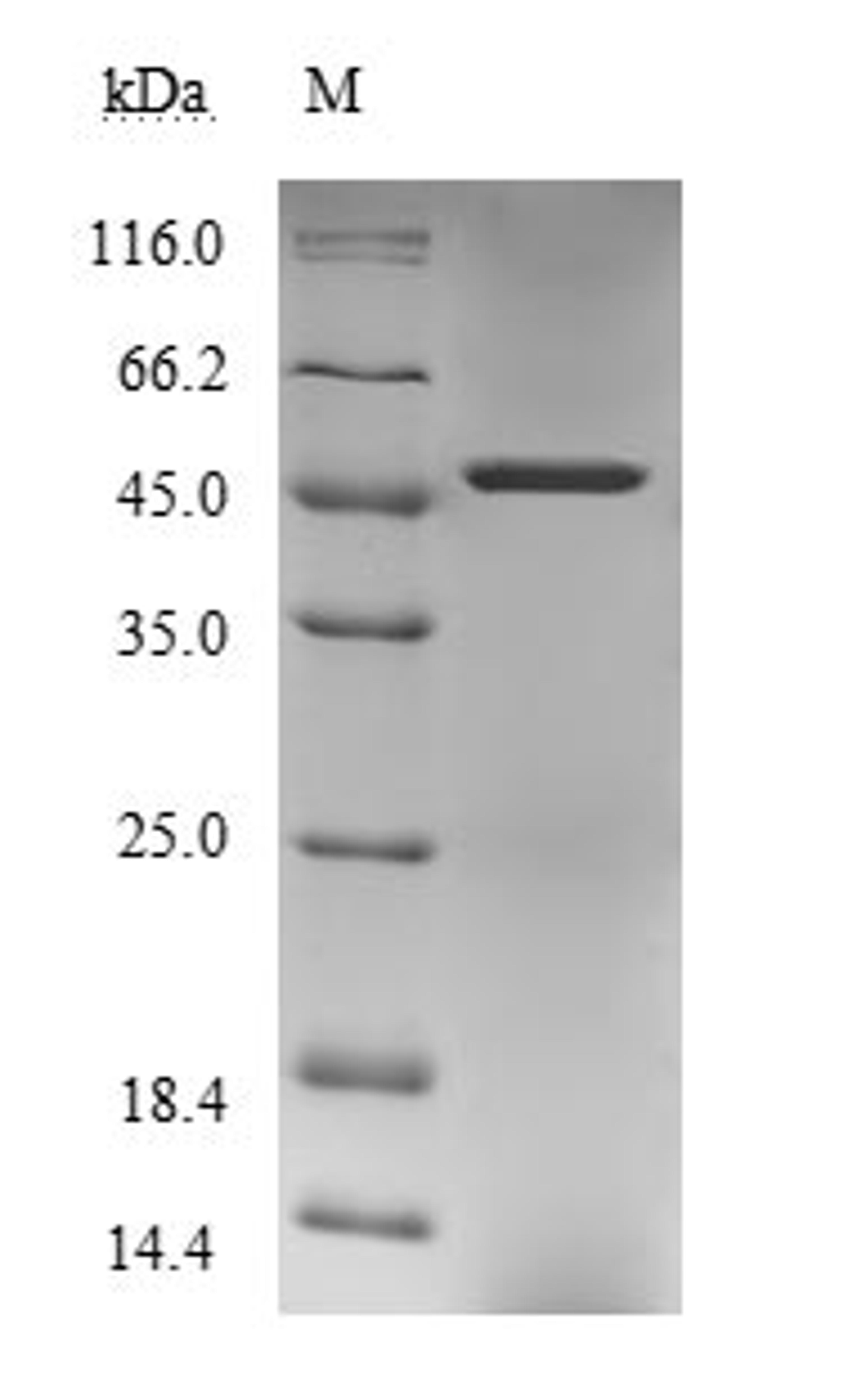 (Tris-Glycine gel) Discontinuous SDS-PAGE (reduced) with 5% enrichment gel and 15% separation gel.