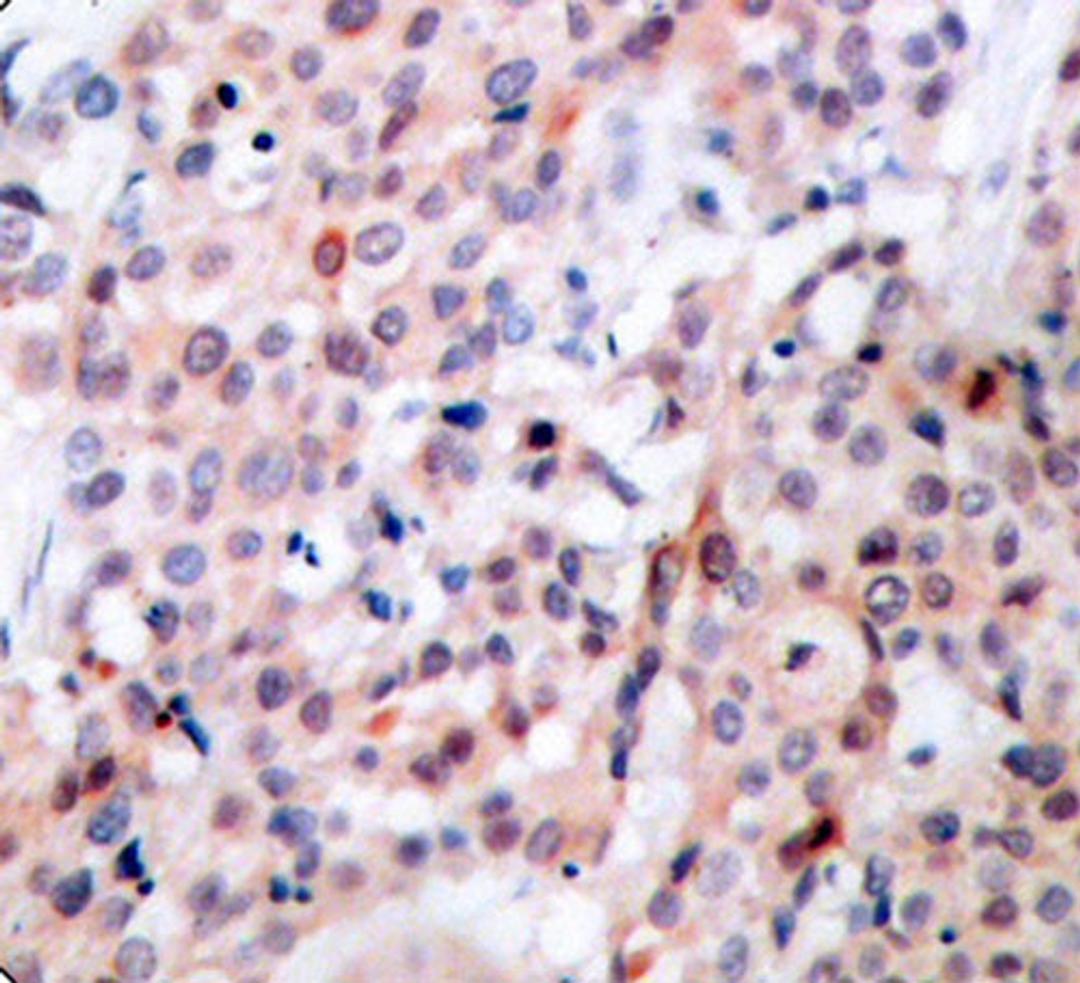 Immunohistochemistry  - Phospho-Bcl-2-T56 antibody (AP0316)