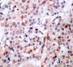 Immunohistochemistry  - Phospho-Bcl-2-T56 antibody (AP0316)