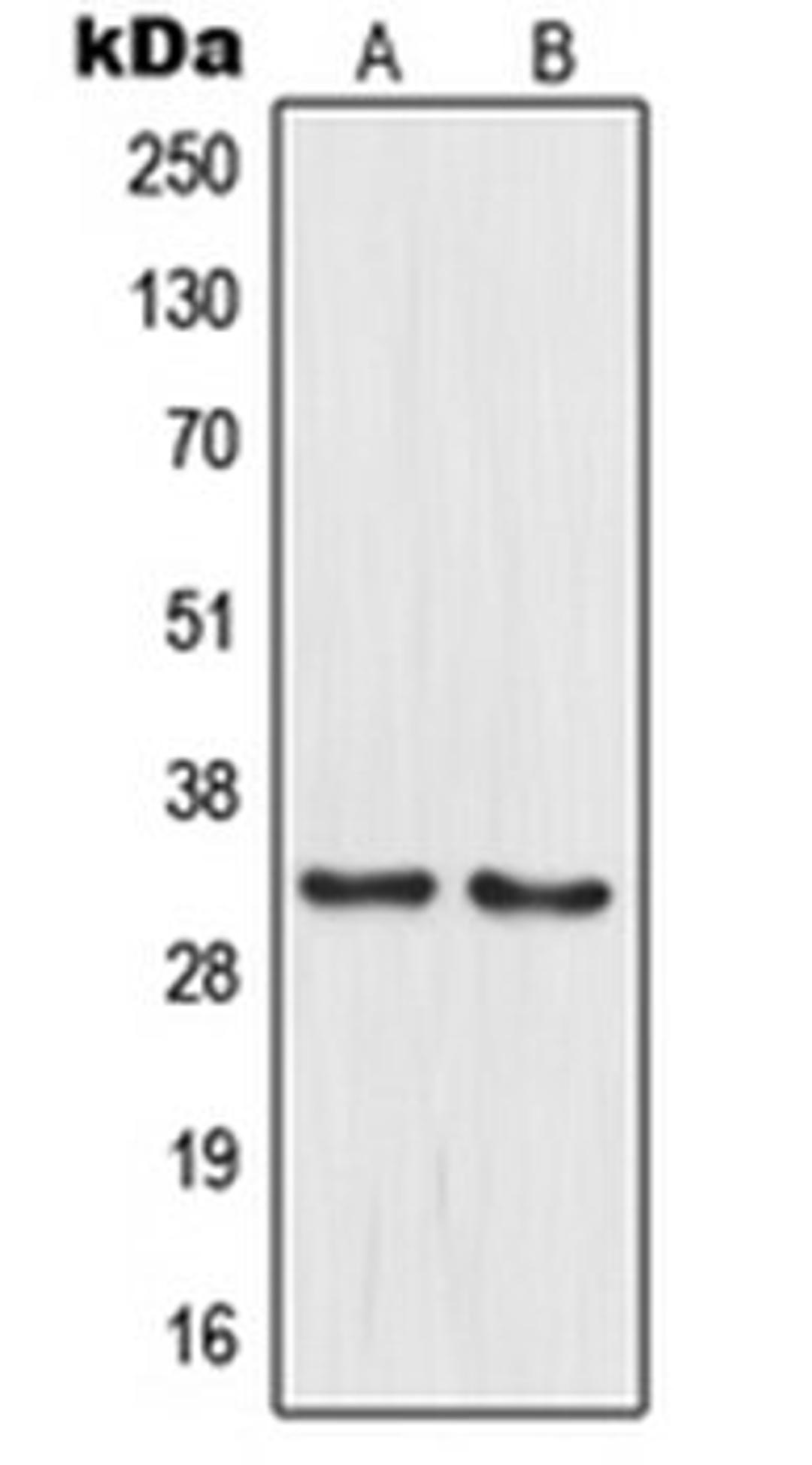 Western blot analysis of PANC1 (Lane 1), HuvEc (Lane 2) whole cell lysates using MRPL15 antibody