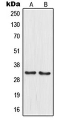 Western blot analysis of PANC1 (Lane 1), HuvEc (Lane 2) whole cell lysates using MRPL15 antibody