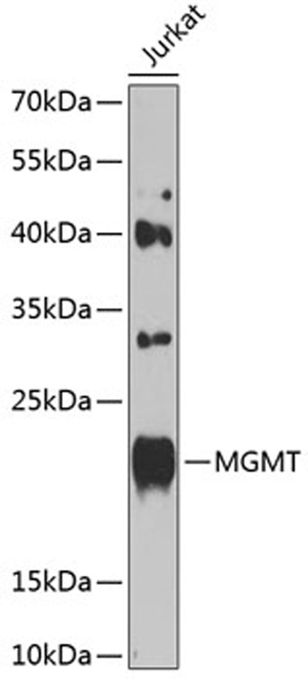 Western blot - MGMT antibody (A0052)