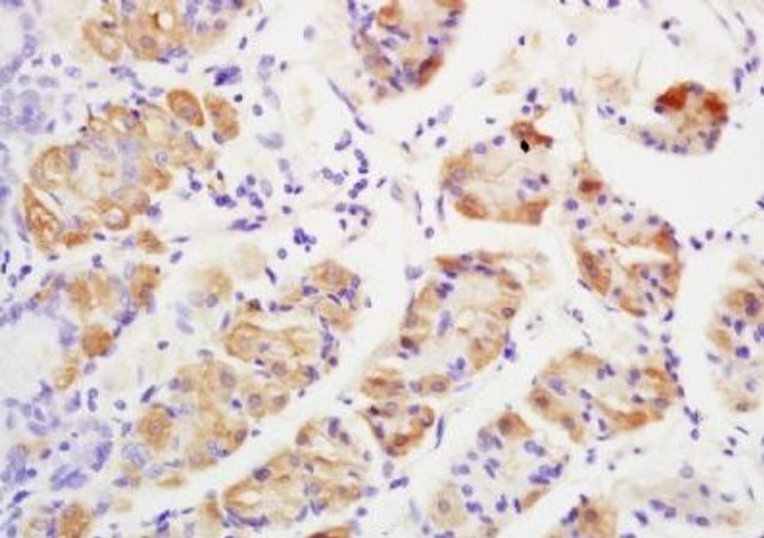 Immunohistochemical analysis of formalin-fixed paraffin embedded human stomach tissue using GRK2 antibody (dilution at 1:200)