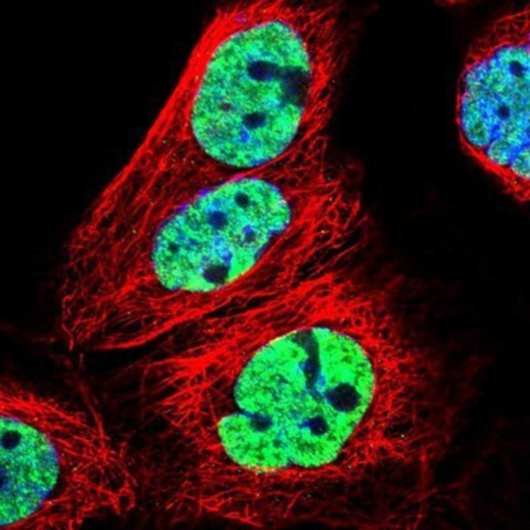 Immunocytochemistry/Immunofluorescence: CMTM2 Antibody [NBP1-85591] - Staining of human cell line A-431 shows positivity in nucleus but not nucleoli.