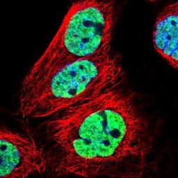 Immunocytochemistry/Immunofluorescence: CMTM2 Antibody [NBP1-85591] - Staining of human cell line A-431 shows positivity in nucleus but not nucleoli.