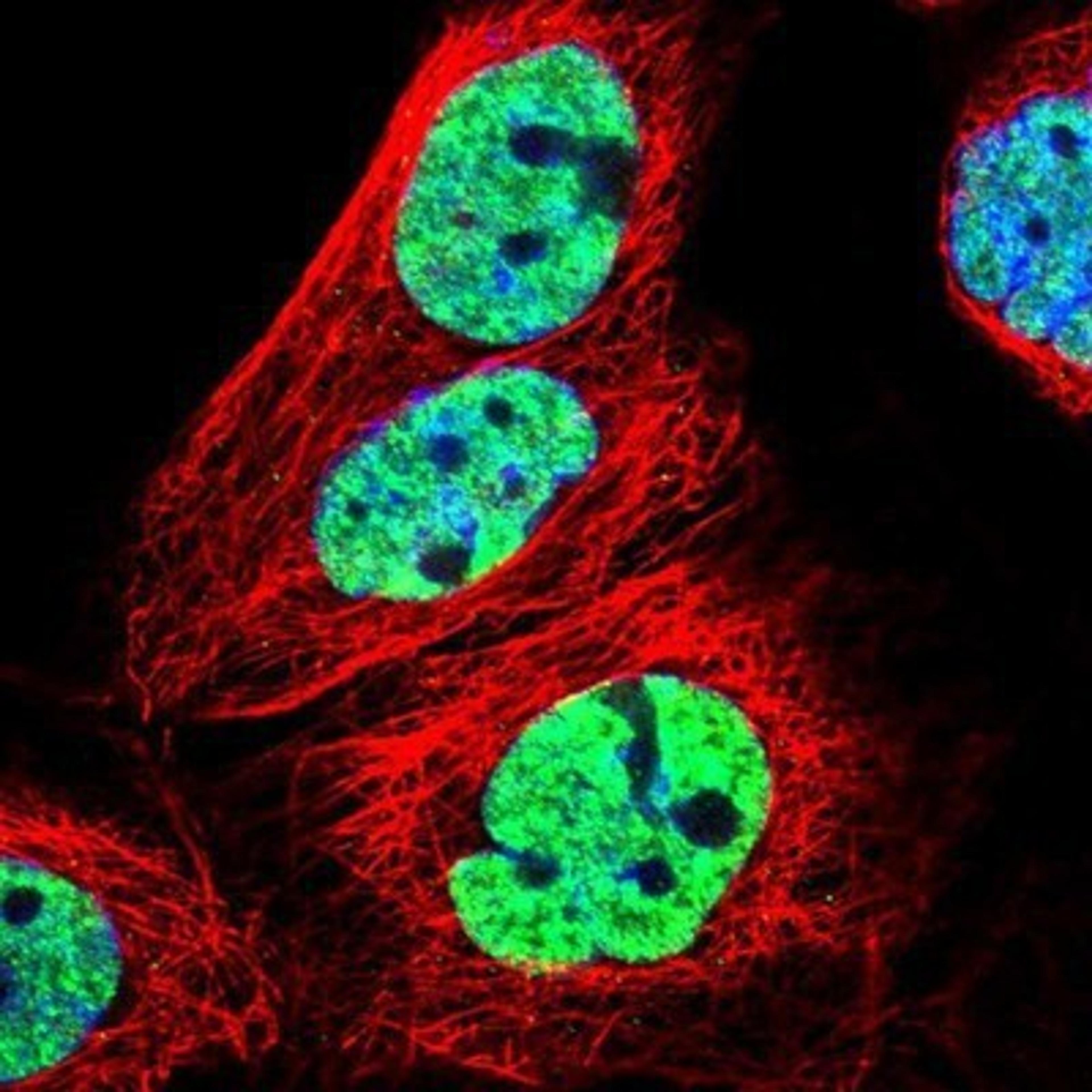 Immunocytochemistry/Immunofluorescence: CMTM2 Antibody [NBP1-85591] - Staining of human cell line A-431 shows positivity in nucleus but not nucleoli.