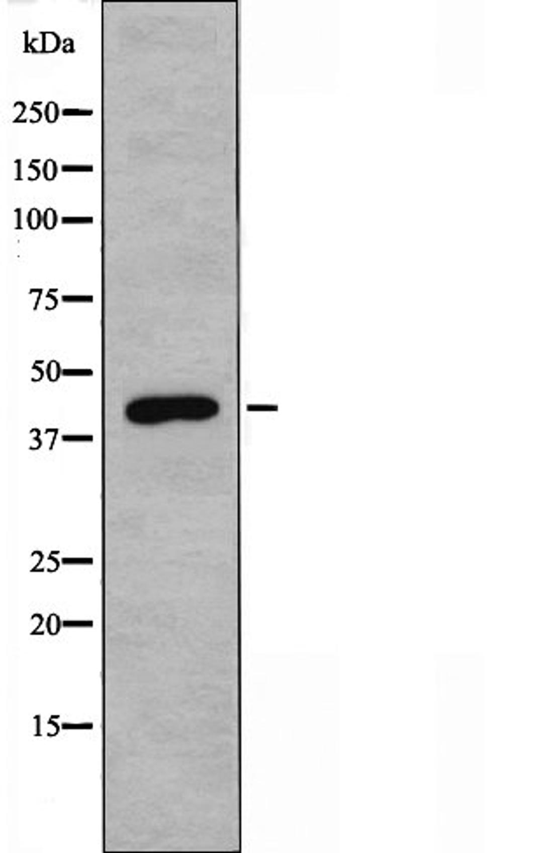 Western blot analysis of Jurkat cells using NTR1 antibody