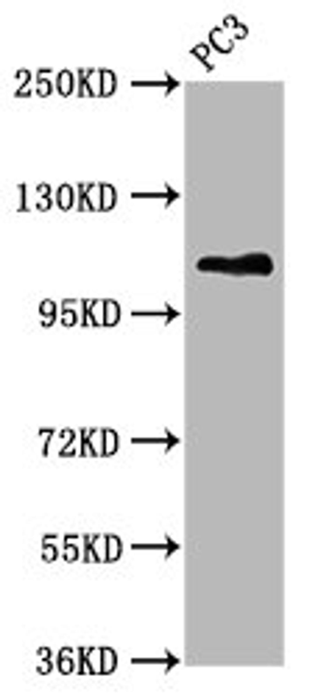 Western Blot. Positive WB detected in: PC-3 whole cell lysate. All lanes: FAN1 antibody at 5.3ug/ml. Secondary. Goat polyclonal to rabbit IgG at 1/50000 dilution. Predicted band size: 115, 60 kDa. Observed band size: 115 kDa.