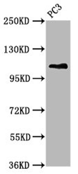 Western Blot. Positive WB detected in: PC-3 whole cell lysate. All lanes: FAN1 antibody at 5.3ug/ml. Secondary. Goat polyclonal to rabbit IgG at 1/50000 dilution. Predicted band size: 115, 60 kDa. Observed band size: 115 kDa.