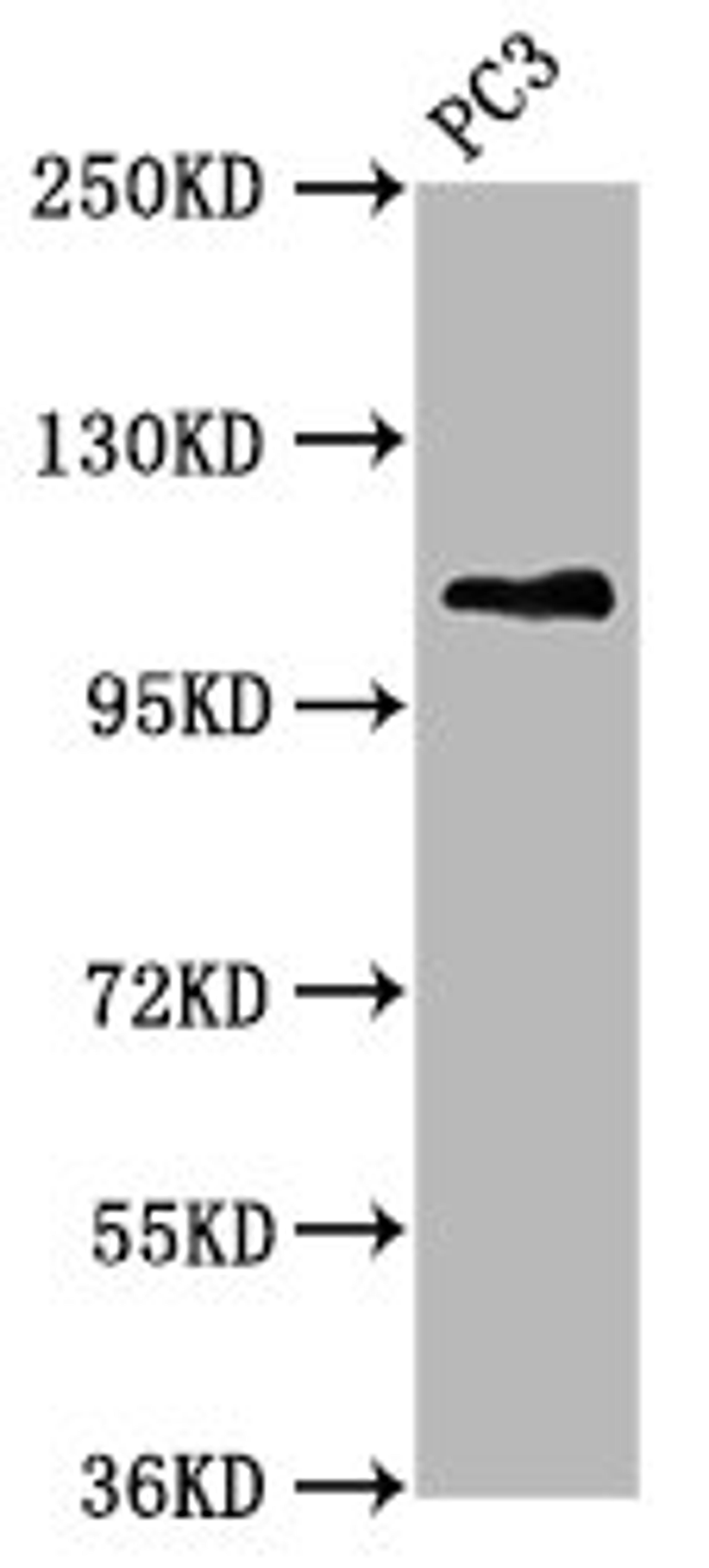 Western Blot. Positive WB detected in: PC-3 whole cell lysate. All lanes: FAN1 antibody at 5.3ug/ml. Secondary. Goat polyclonal to rabbit IgG at 1/50000 dilution. Predicted band size: 115, 60 kDa. Observed band size: 115 kDa.