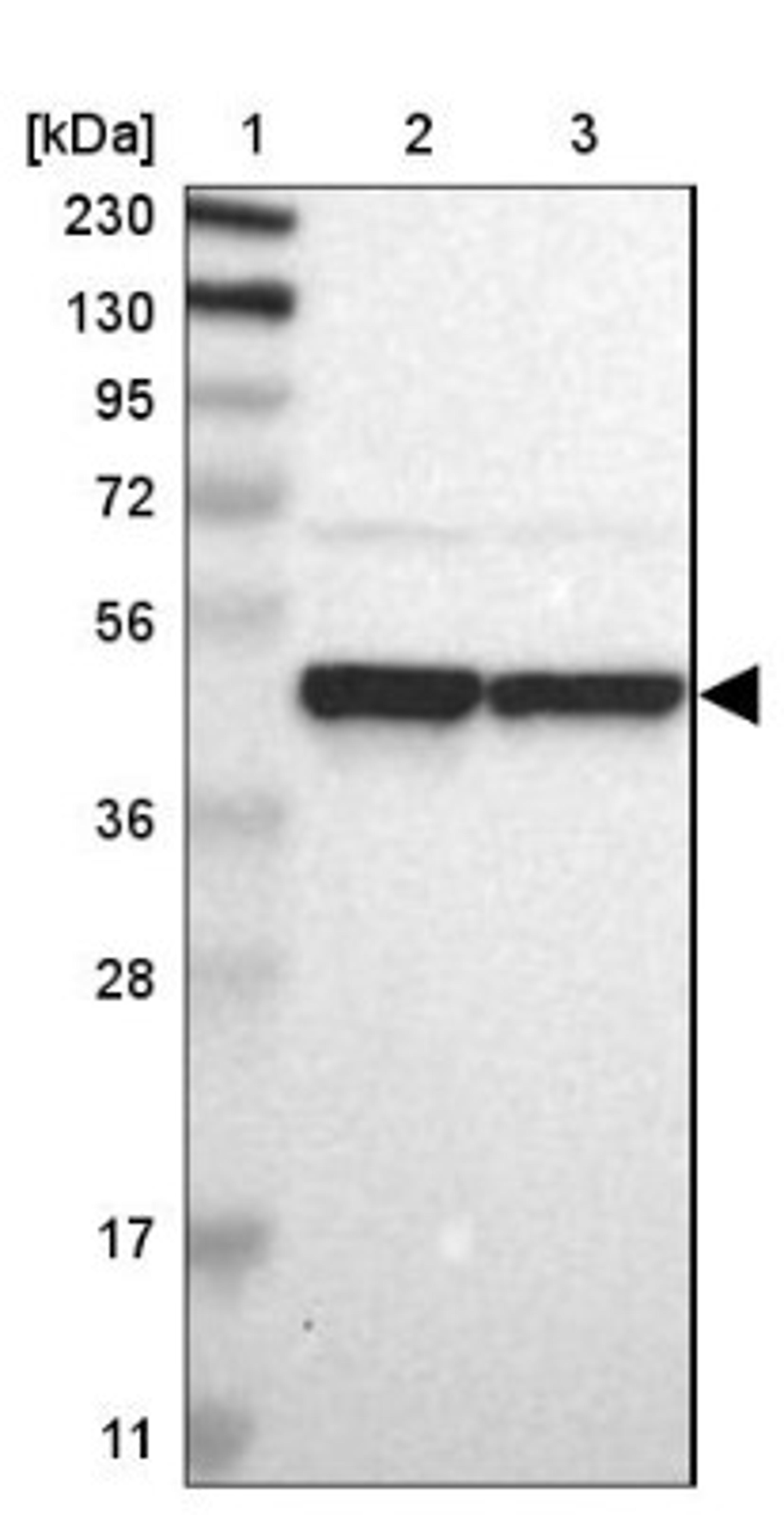 Western Blot: FAM98B Antibody [NBP1-83474] - Lane 1: Marker [kDa] 230, 130, 95, 72, 56, 36, 28, 17, 11<br/>Lane 2: Human cell line RT-4<br/>Lane 3: Human cell line U-251MG sp