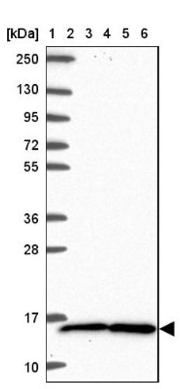 Western Blot: TAX1BP3 Antibody [NBP2-38016] - Lane 1: Marker [kDa] 250, 130, 95, 72, 55, 36, 28, 17, 10<br/>Lane 2: RT-4<br/>Lane 3: U-251 MG<br/>Lane 4: Human Plasma<br/>Lane 5: Liver<br/>Lane 6: Tonsil