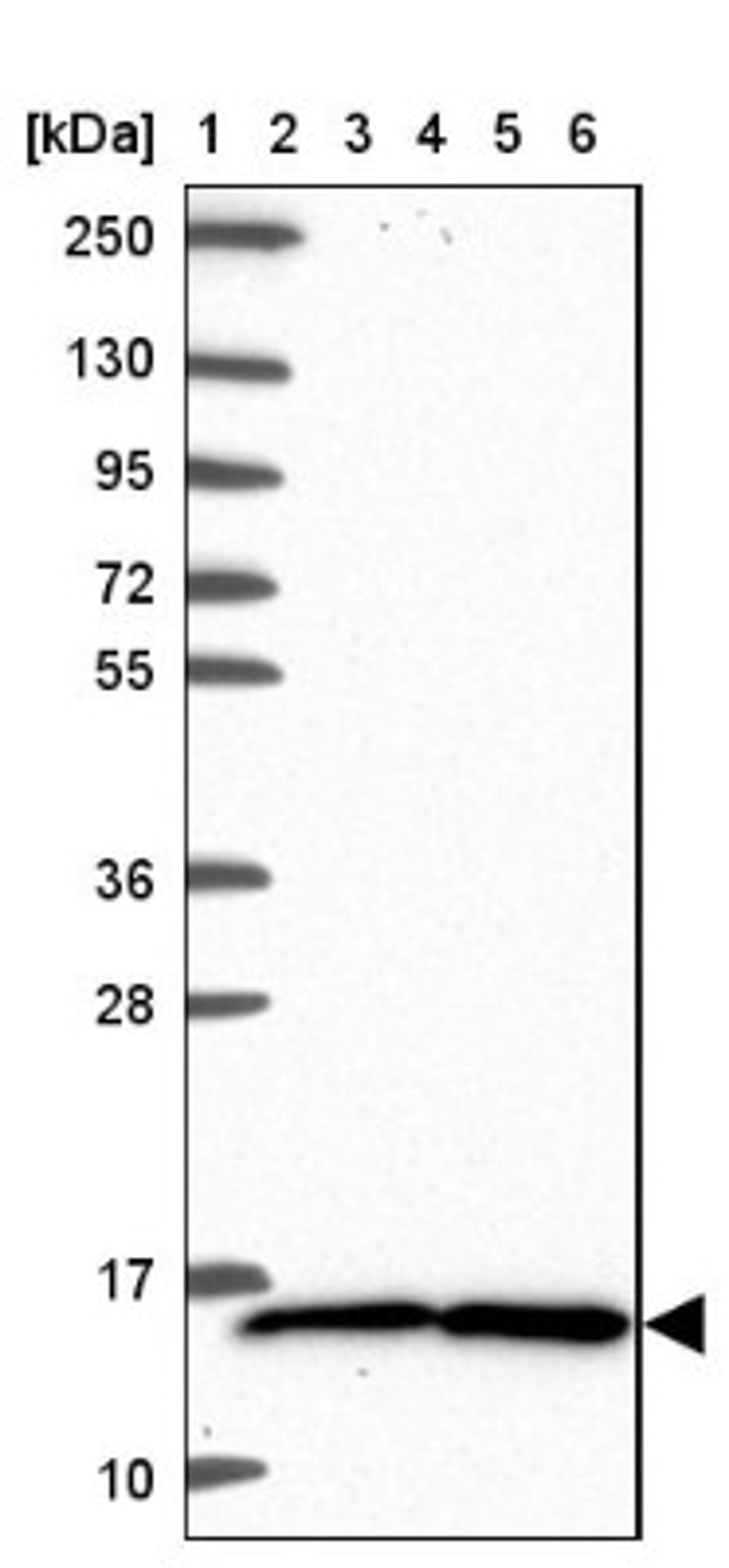 Western Blot: TAX1BP3 Antibody [NBP2-38016] - Lane 1: Marker [kDa] 250, 130, 95, 72, 55, 36, 28, 17, 10<br/>Lane 2: RT-4<br/>Lane 3: U-251 MG<br/>Lane 4: Human Plasma<br/>Lane 5: Liver<br/>Lane 6: Tonsil