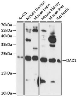 Western blot - DAD1 antibody (A14723)