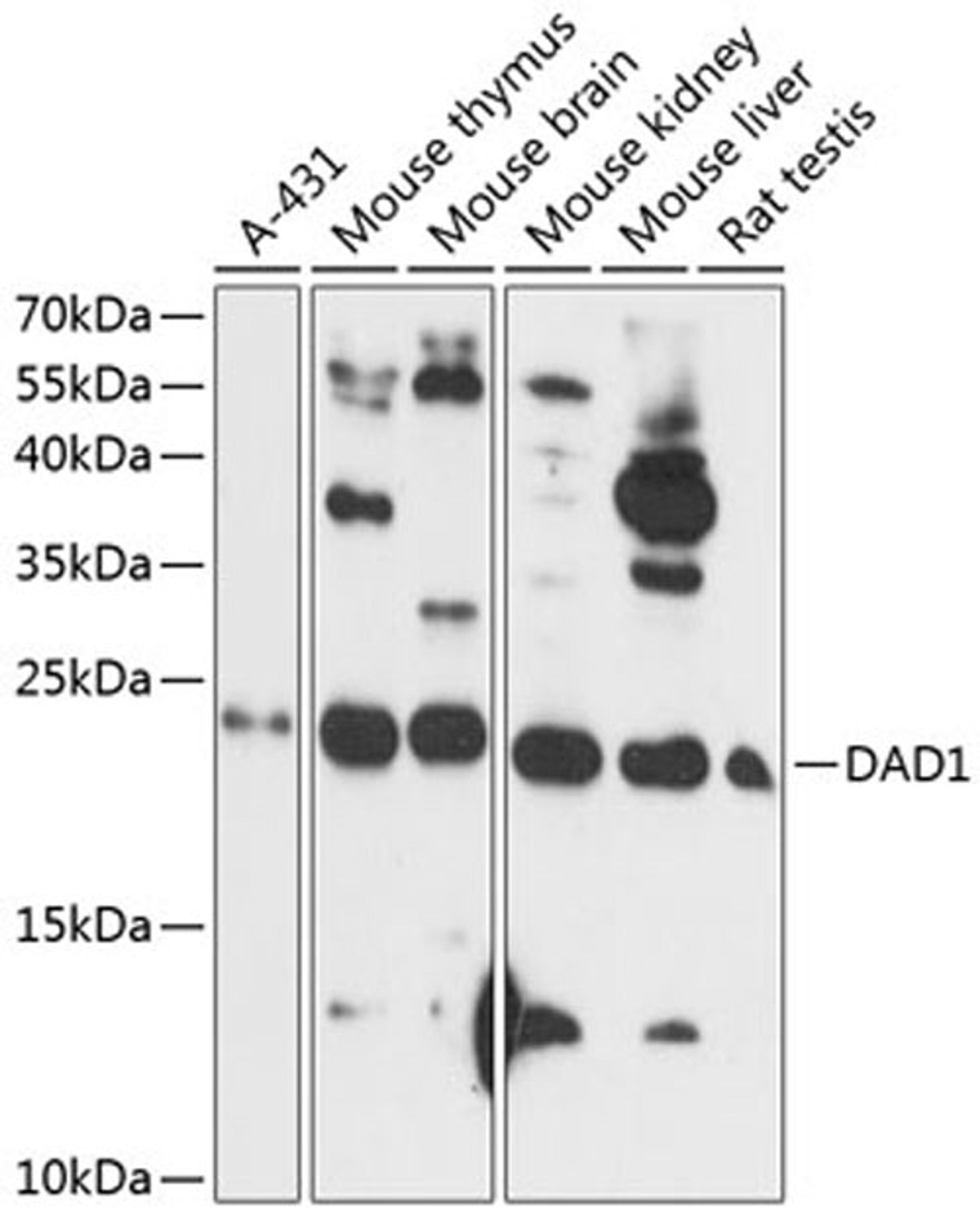 Western blot - DAD1 antibody (A14723)