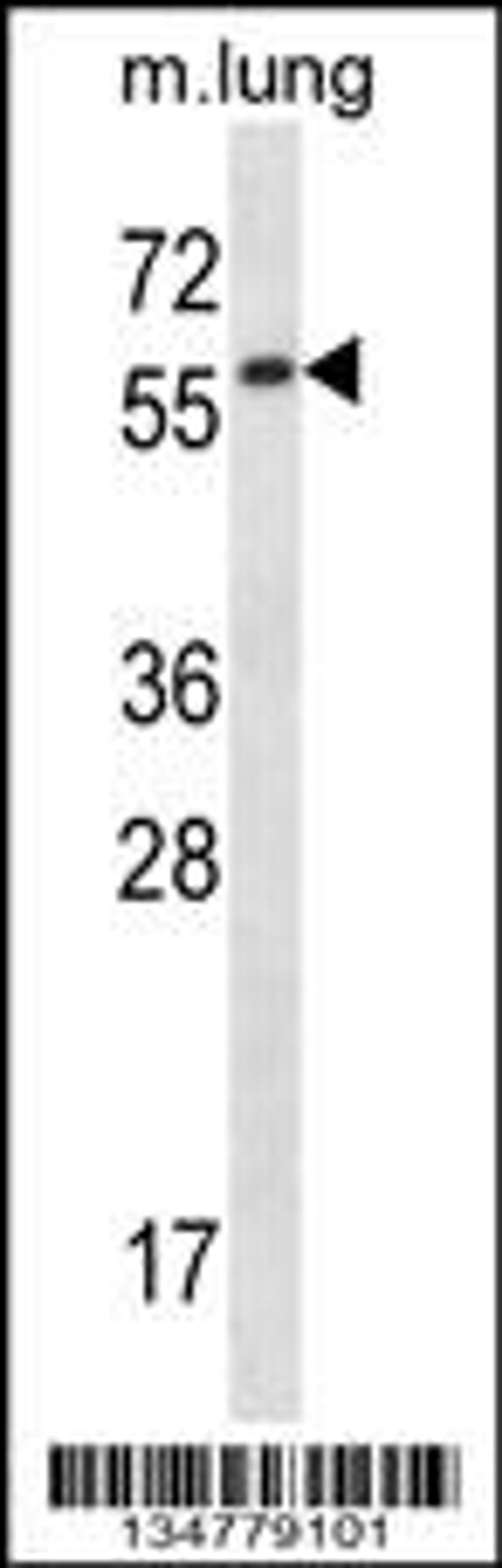 Western blot analysis in mouse lung tissue lysates (35ug/lane).This demonstratedetected the Fyn protein (arrow).