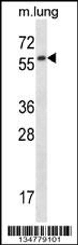 Western blot analysis in mouse lung tissue lysates (35ug/lane).This demonstratedetected the Fyn protein (arrow).