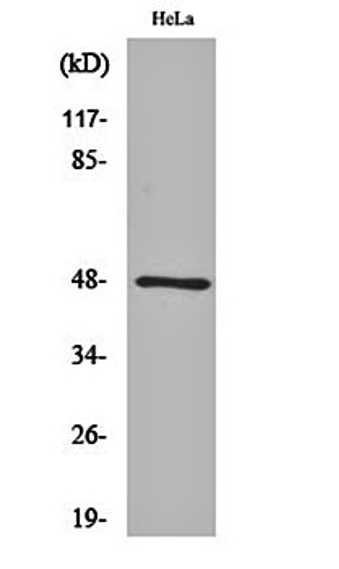 Western blot analysis of Hela cell lysates using GATA-4 antibody