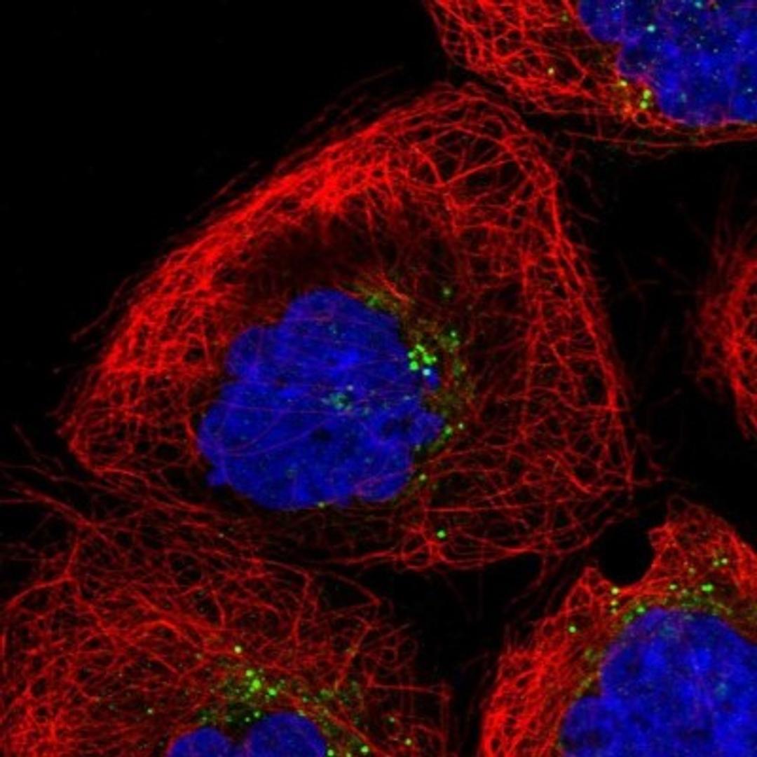 Immunocytochemistry/Immunofluorescence: TMEM231 Antibody [NBP1-91905] - Staining of human cell line A-431 shows positivity in vesicles.